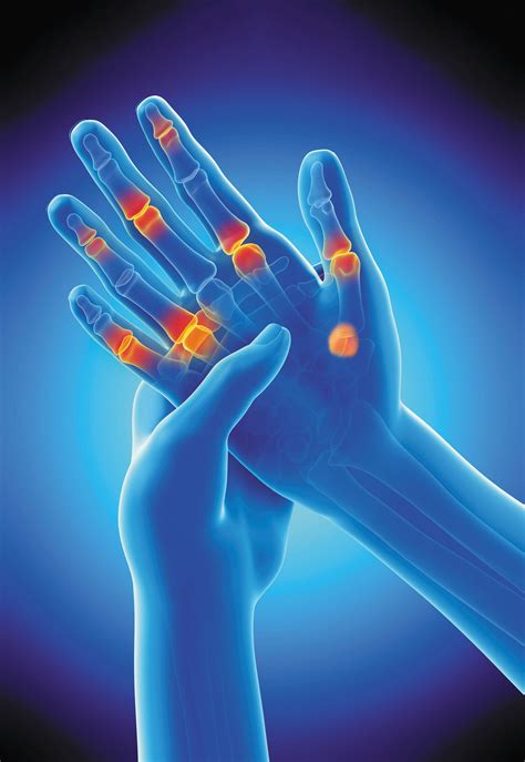 hartes fingern|Identifying arthritis in your fingers and thumbs .